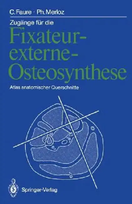 Cover of Zugänge Für Die Fixateur-Externe-Osteosynthese