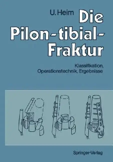 Cover of Die Pilon-Tibial-Fraktur