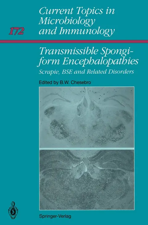 Cover of Transmissible Spongiform Encephalopathies