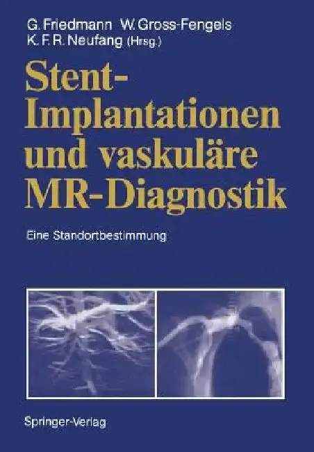 Cover of Stent-Implantationen Und Vaskuläre Mr-Diagnostik