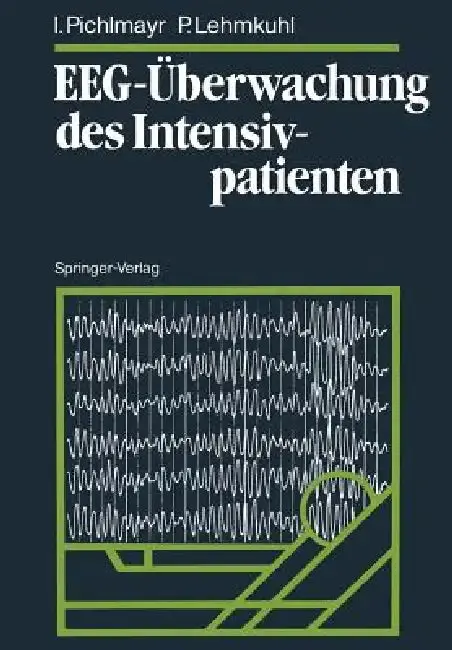 Cover of Eeg-Überwachung Des Intensivpatienten