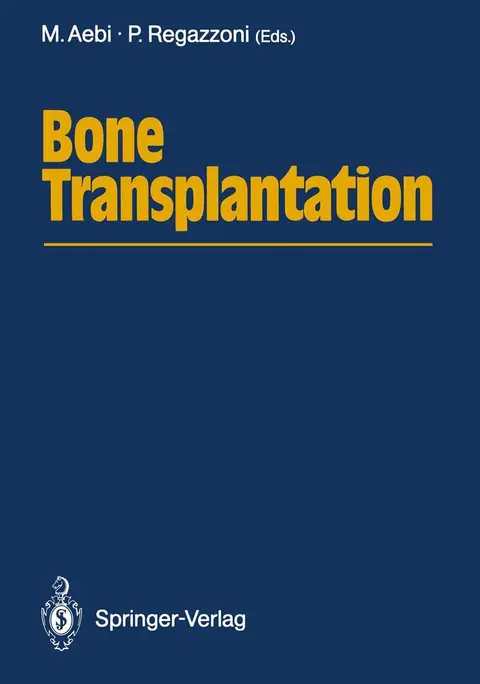 Cover of Bone Transplantation