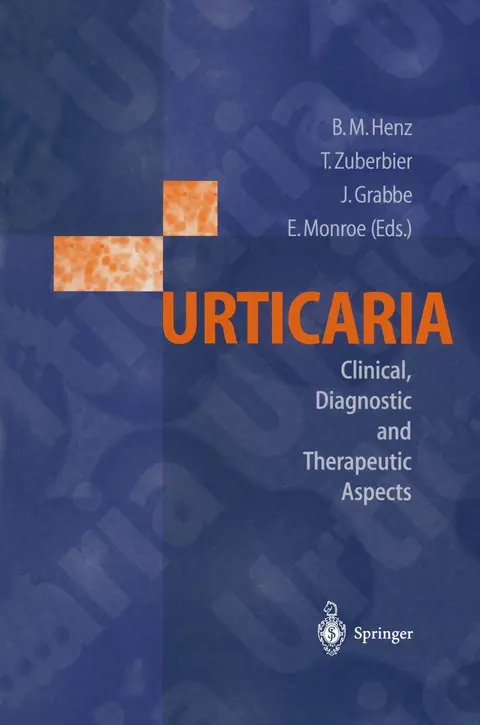 Cover of Urticaria