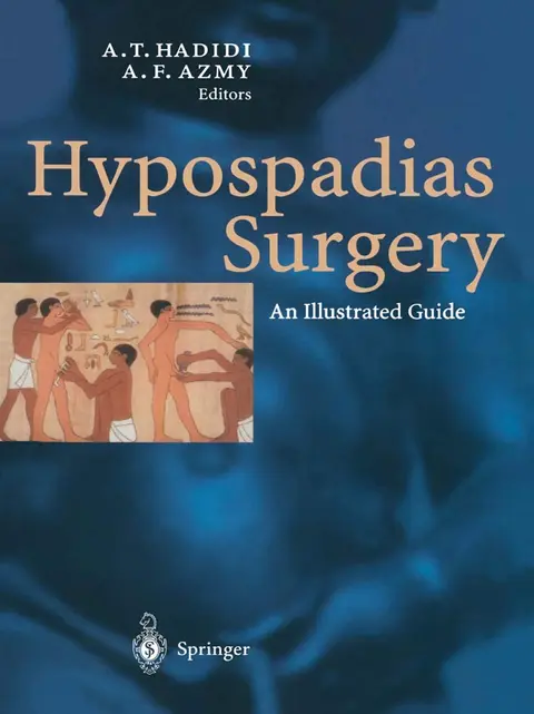 Cover of Hypospadias Surgery