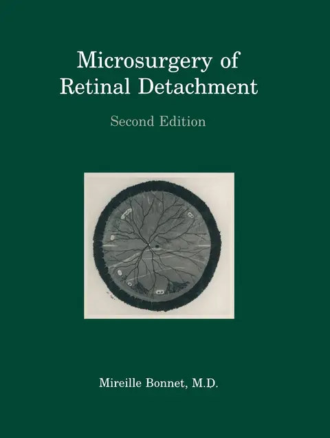 Cover of Microsurgery of Retinal Detachment