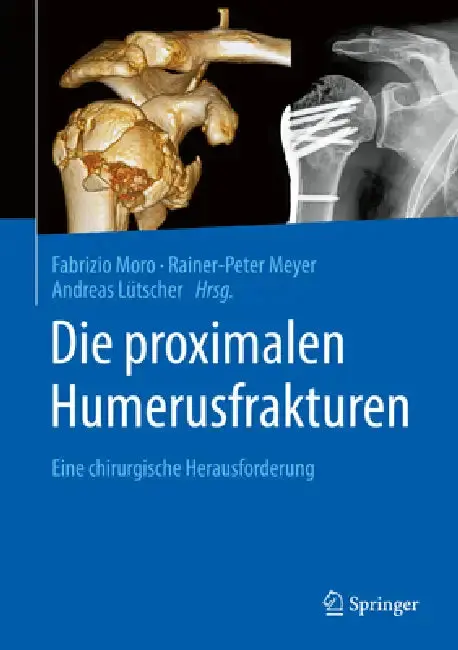 Cover of Die Proximalen Humerusfrakturen