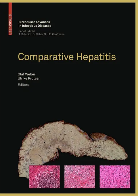 Cover of Comparative Hepatitis