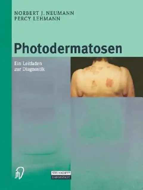 Cover of Photodermatosen