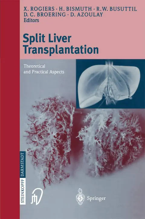 Cover of Split Liver Transplantation