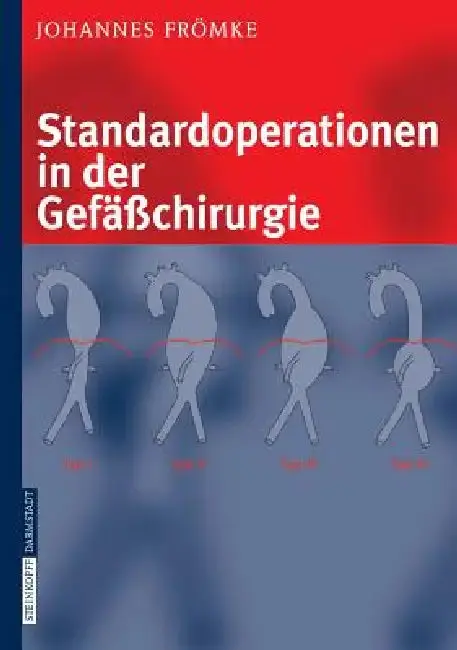 Cover of Standardoperationen in Der Gefäßchirurgie
