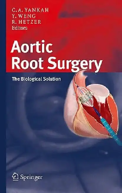 Cover of Aortic Root Surgery