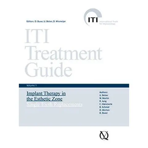 Cover of ITI Treatment Guide
