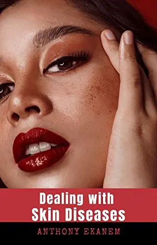 Cover of Dealing with Skin Diseases