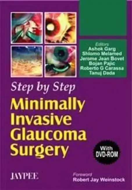Cover of Step By Step Minimally Invasive Glaucoma Surgery With Dvd-Rom