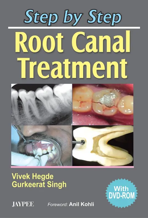 Cover of Step by Step Root Canal Treatment