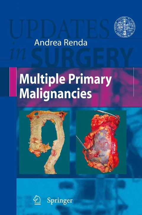 Cover of Multiple Primary Malignancies