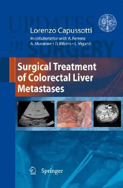 Cover of Surgical Treatment of Colorectal Liver Metastases