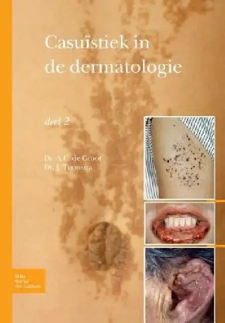 Cover of Casuïstiek in de Dermatologie - Deel 2