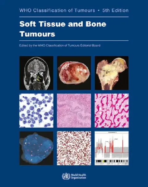 Cover of Soft Tissue and Bone Tumours
