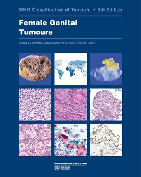 Cover of Female Genital Tumours