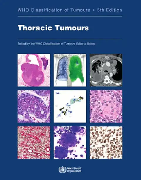 Cover of Thoracic Tumours