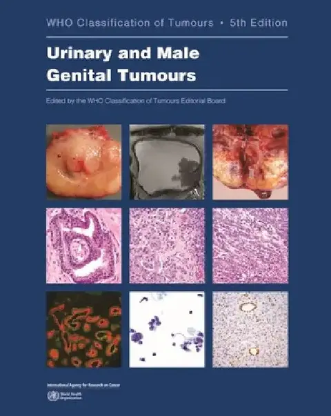 Cover of Urinary and Male Genital Tumours