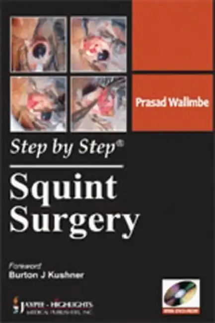 Cover of Step By Step Squint Surgery