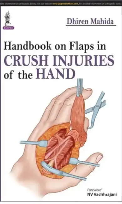 Cover of Handbook On Flaps In Crush Injuries Of The Hand