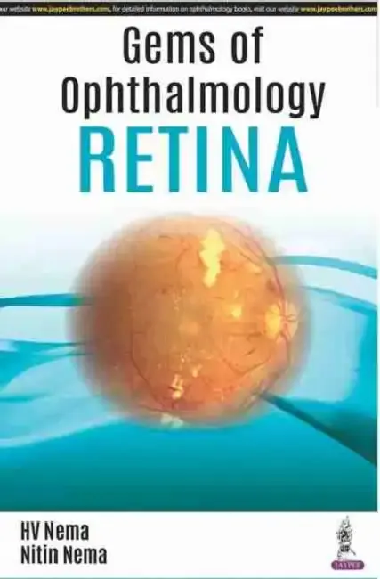 Cover of Gems Of Ophthalmology Retina