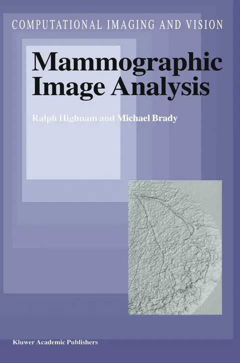 Cover of Mammographic Image Analysis
