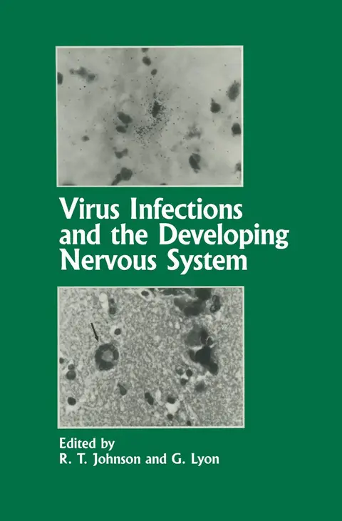 Cover of Virus Infections and the Developing Nervous System