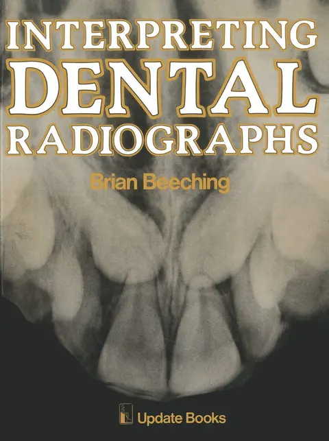 Cover of Interpreting Dental Radiographs