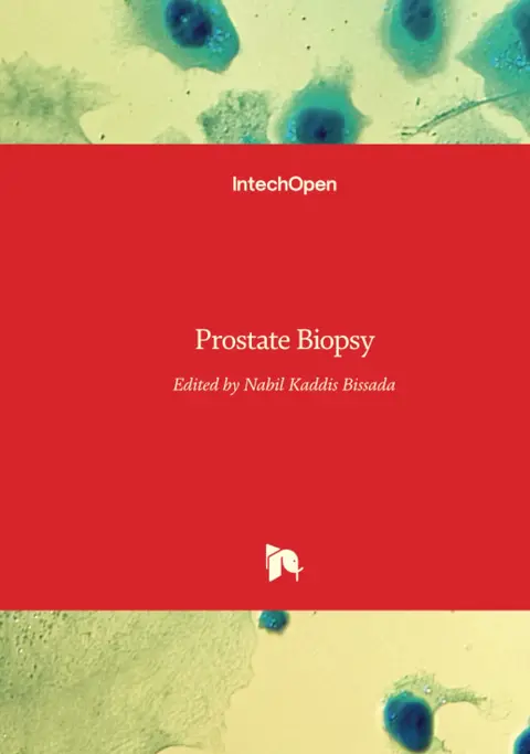 Cover of Prostate Biopsy