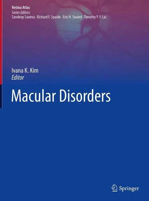 Cover of Macular Disorders